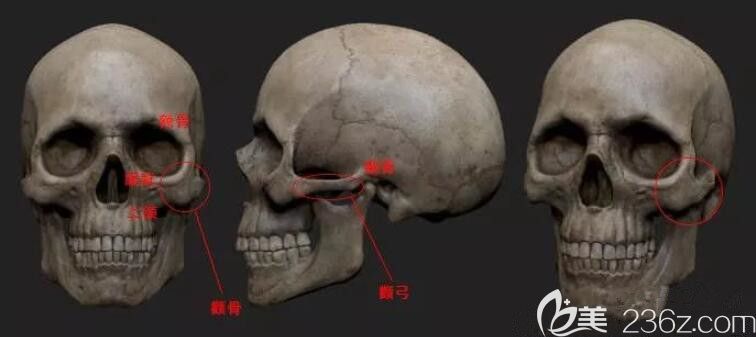 顴骨顴弓面骨部位