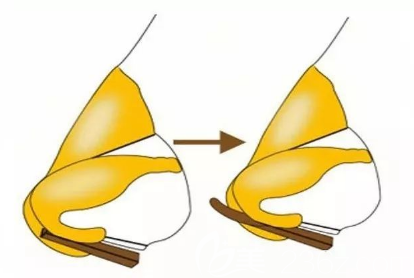 鼻頭的內(nèi)部構(gòu)造