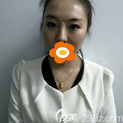 術(shù)后半個(gè)月有點(diǎn)憔悴 術(shù)后半個(gè)月有點(diǎn)憔悴