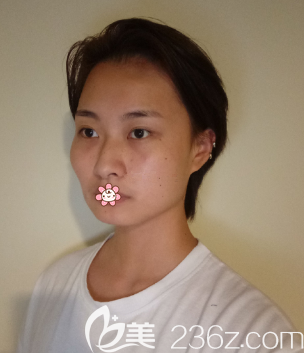 術(shù)前的我 術(shù)前的我