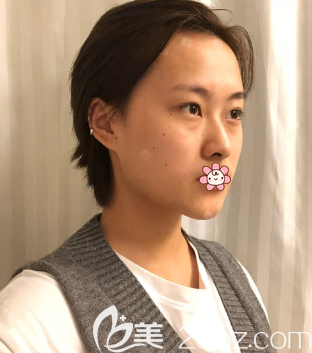 側(cè)面的樣子 側(cè)面的樣子