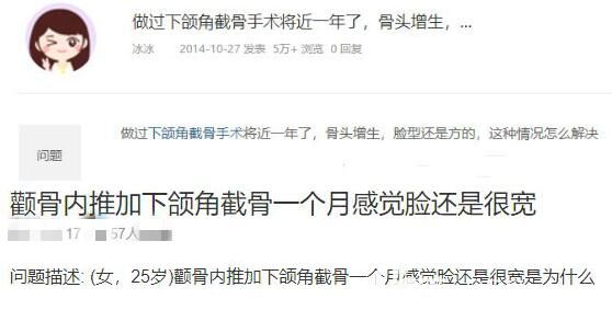 下頜骨截骨后臉還是很寬怎么辦