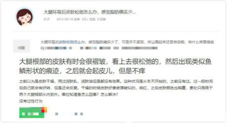 大腿吸脂后后遺癥問題