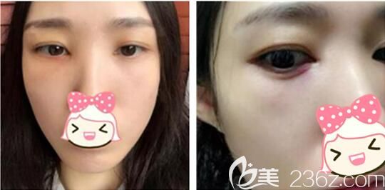 現在眼睛發(fā)紅 現在眼睛發(fā)紅