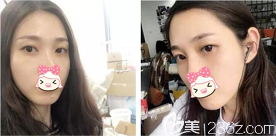 半個多月后 半個多月后