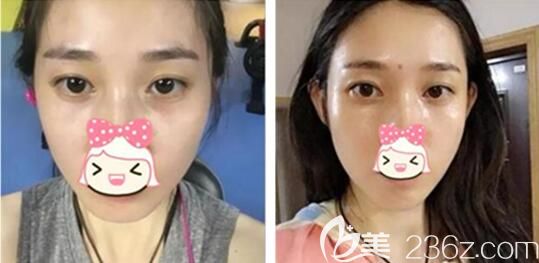 運動完出很多汗 運動完出很多汗