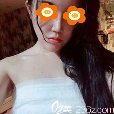 術(shù)后3天胸部還纏著紗布