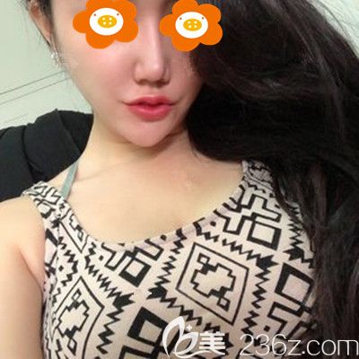 術(shù)后1個(gè)月胸還有點(diǎn)硬