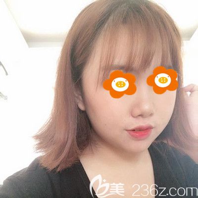 術后半個月照片 術后半個月照片