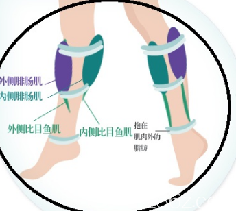 小腿神經(jīng)切斷術(shù)