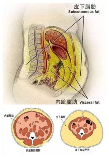 皮下脂肪和內(nèi)臟脂肪的區(qū)別