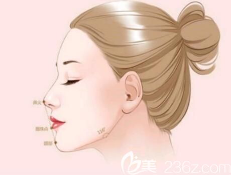 墊下巴假體好還是注射玻尿酸好？