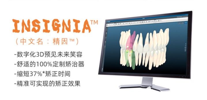 insignia牙套的個(gè)性化定制