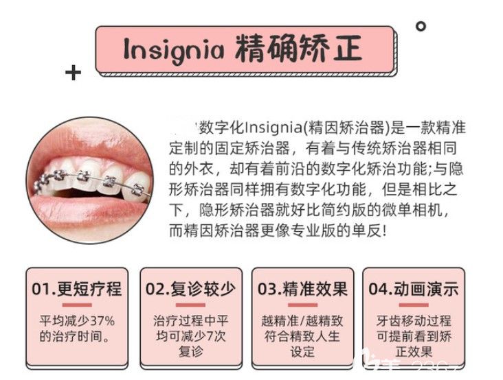 Insignia精準(zhǔn)矯正的優(yōu)缺點(diǎn)