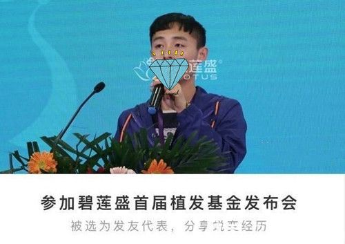 成功蛻變長(zhǎng)出頭發(fā)把經(jīng)歷分享給大家 成功蛻變長(zhǎng)出頭發(fā)把經(jīng)歷分享給大家