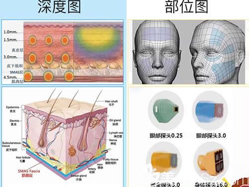 熱瑪吉工作原理