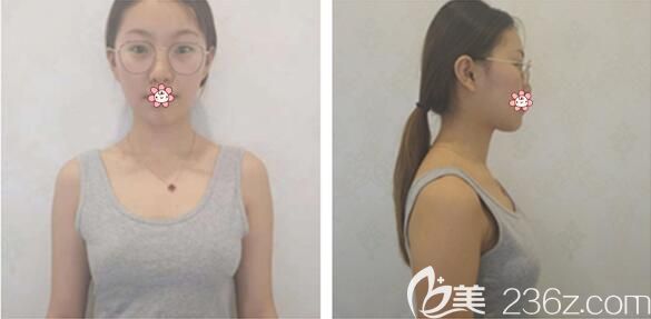 之前的我 之前的我