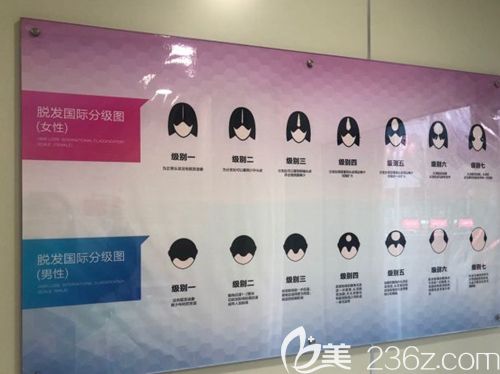 不同的脫發(fā)類型分級