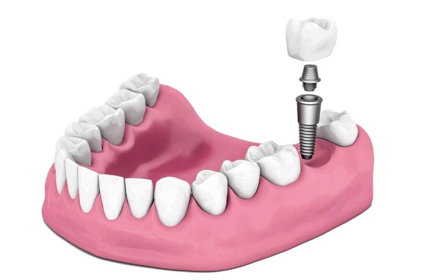 高醫(yī)生比較擅長的項(xiàng)目 高醫(yī)生比較擅長的項(xiàng)目
