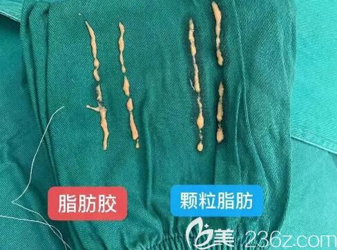 脂肪膠和脂肪的區(qū)別