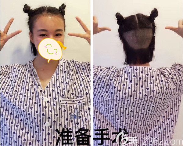 精神滿滿的我要去植發(fā)啦