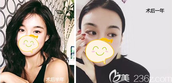 ?植發(fā)后多久可以帶帽子遮丑?這個問題我在做發(fā)際線種植的時候也問過醫(yī)生