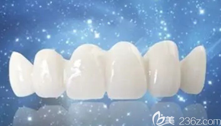 牙齒貼面和烤瓷牙的區(qū)別