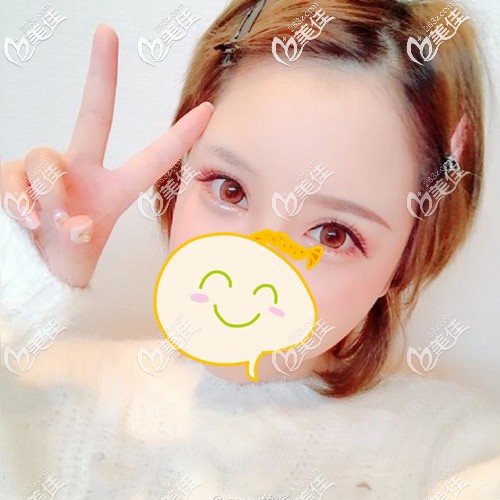 我方方的~大腦門 我方方的~大腦門