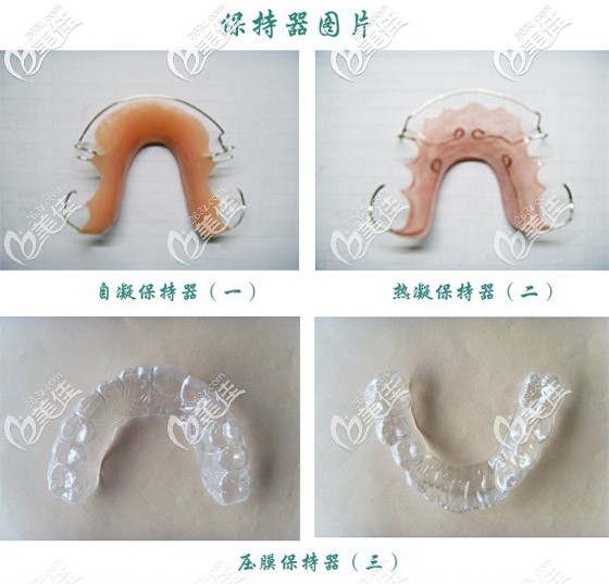 沈陽(yáng)米蘭口腔彭陽(yáng)醫(yī)生介紹保持器的種類 沈陽(yáng)米蘭口腔彭陽(yáng)醫(yī)生介紹保持器的種類