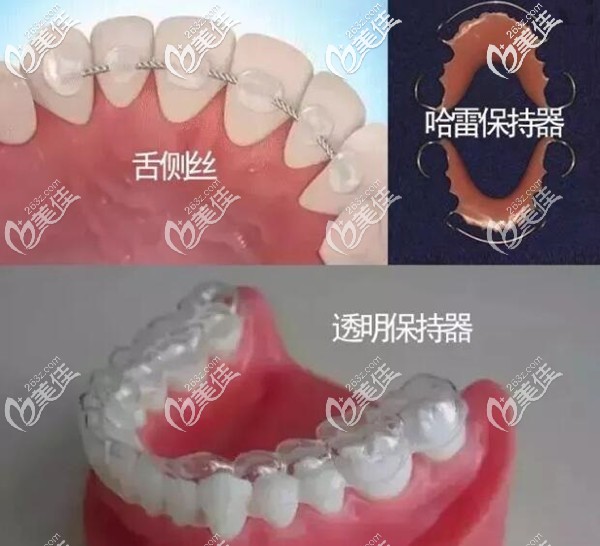 牙齒矯正后保持器要戴一輩子嗎 牙齒矯正后保持器要戴一輩子嗎