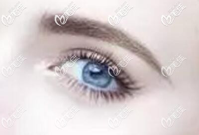 越來越多的人通過做雙眼皮術(shù)改善單眼皮