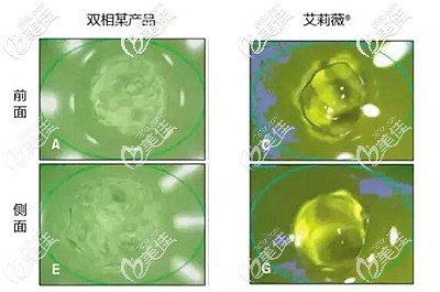 艾莉薇玻尿酸的優(yōu)勢(shì)
