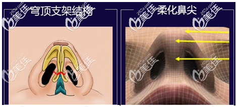 北京美萊醫(yī)生相關(guān)技術(shù)宣傳圖