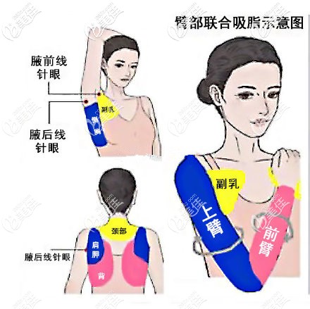 20200402_1585819769735467.jpg 65719491ly1gdd7njbpgnj20i00hyagz.jpg