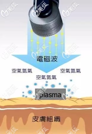 Plasma治療原理 Plasma治療原理