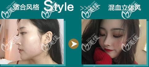 成都隆鼻好的醫(yī)院銅雀臺 成都隆鼻好的醫(yī)院銅雀臺