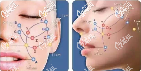 尤軍院長的尤立美面雕術(shù) 尤軍院長的尤立美面雕術(shù)