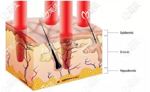 周海燕在激光美膚方面經(jīng)驗豐富 周海燕在激光美膚方面經(jīng)驗豐富