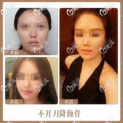 20200410_1586487103971461.jpg ee18ef191f76a5346d323fe9e97e8d0d_400.jpg