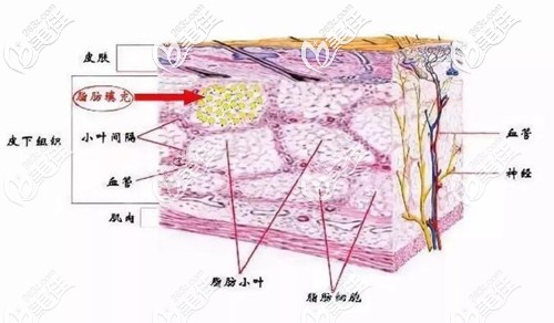 皮下脂肪分布原理圖