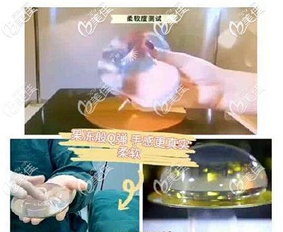 傲諾拉星熠系列假體的優(yōu)勢