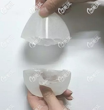 寶儷假體的制作工藝的優(yōu)勢(shì) 寶儷假體的制作工藝的優(yōu)勢(shì)