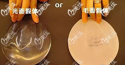 隆胸假體光面和毛面的區(qū)別 隆胸假體光面和毛面的區(qū)別