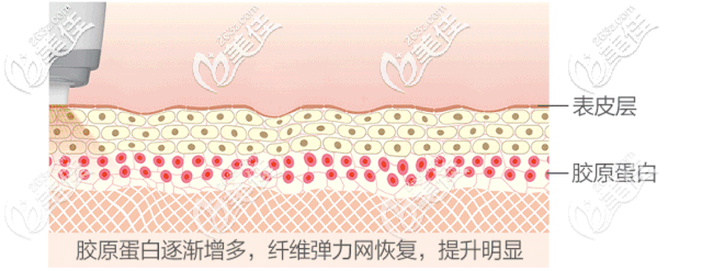 黃金熱瑪吉的作用原理 黃金熱瑪吉的作用原理