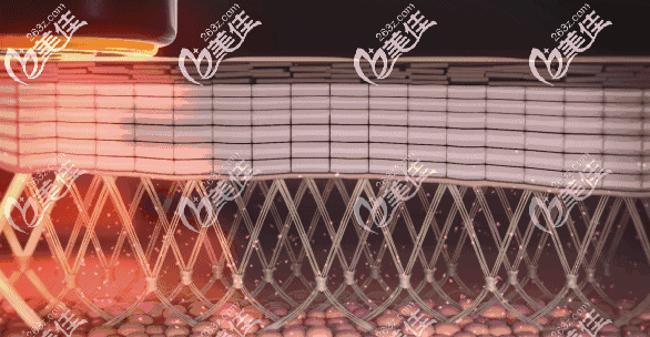 黃金熱瑪吉的具體功效 黃金熱瑪吉的具體功效