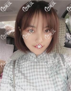 臉真的變小了很多 臉真的變小了很多