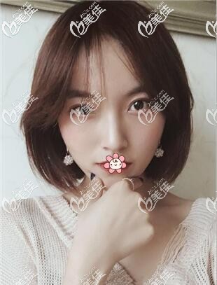 在泰國然禧醫(yī)院做顴骨內(nèi)推+下頜角花了不到六萬 在泰國然禧醫(yī)院做顴骨內(nèi)推+下頜角花了不到六萬