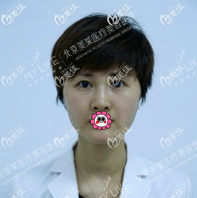 面頰下垂且輪廓不清晰的我 面頰下垂且輪廓不清晰的我