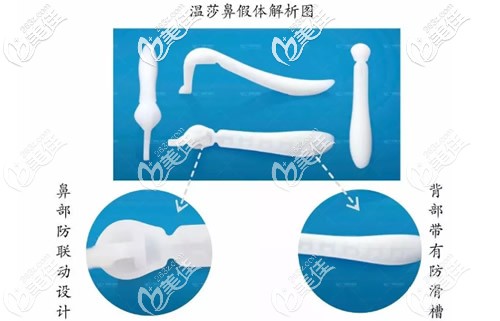 溫莎鼻假體解析圖