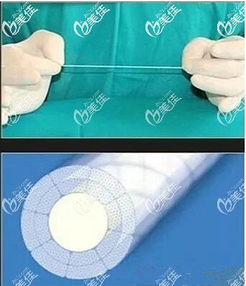 硅膠彈力線的技術優(yōu)勢